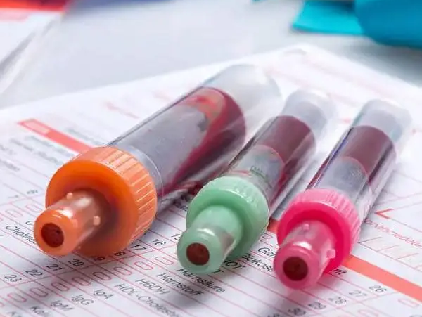 amh偏低也許是卵巢功能衰退