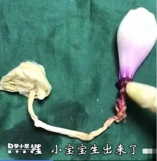 洋蔥模仿剖腹產第4步