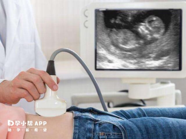 超声波扫描可以看胎儿是男是女
