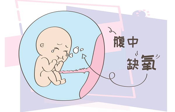 不當使用鹽酸利托君片可能會引起胎兒缺氧