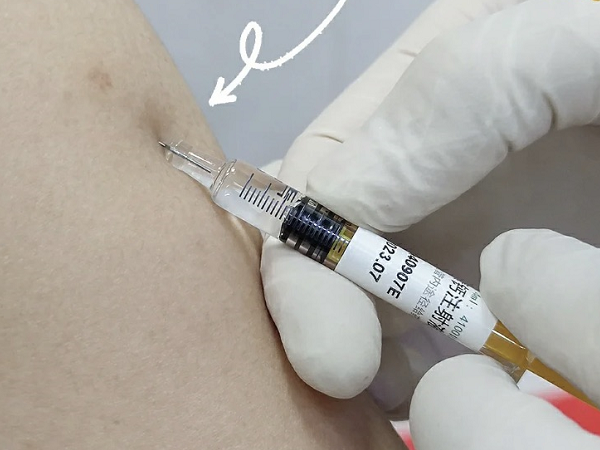 法安明一针的价格是30-60元