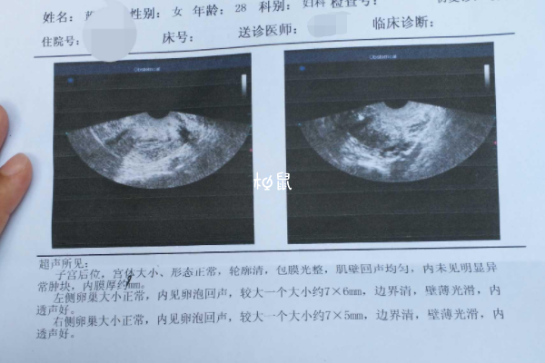 卵泡发育情况和天数有关