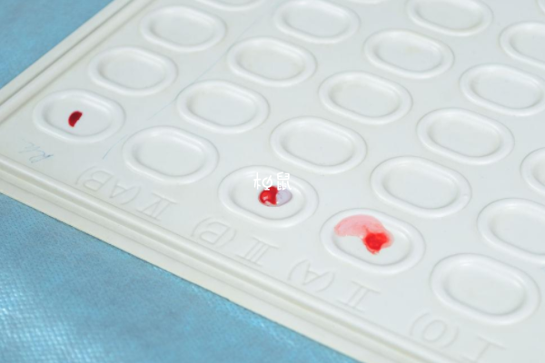 血型遺傳基於孟德爾遺傳原理