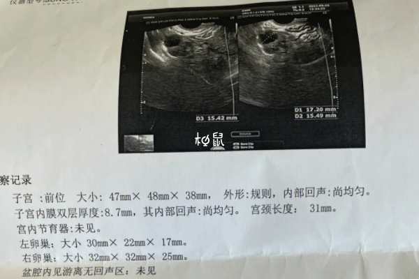 卵泡监测具体要按流程进行