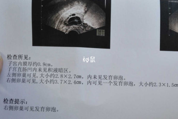監測卵泡報告數字能看發育情況