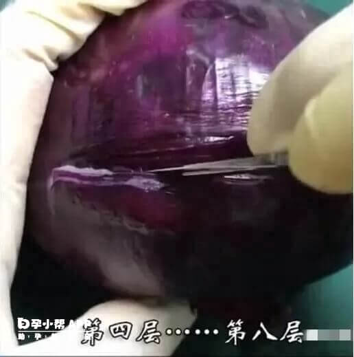 洋蔥模仿剖腹產第二步