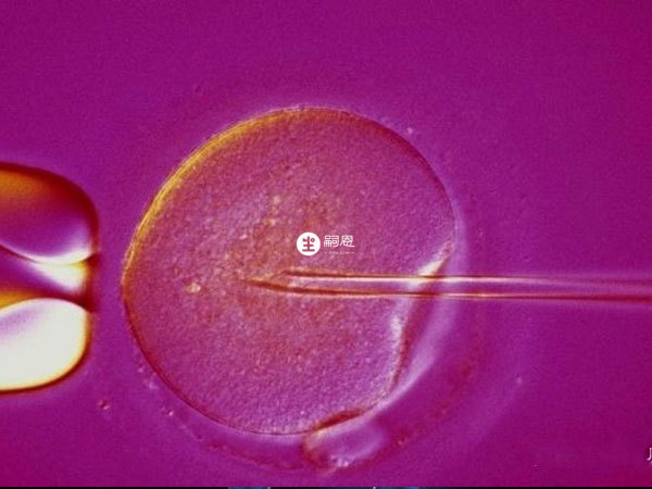 輸卵管堵塞可以通過試管嬰兒助孕