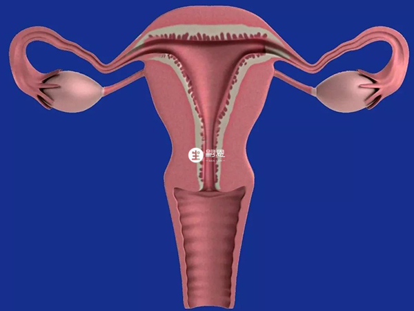 内分泌失调会间接导致多囊卵巢