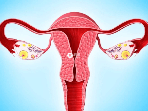 很多女性都检查出输卵管粘连