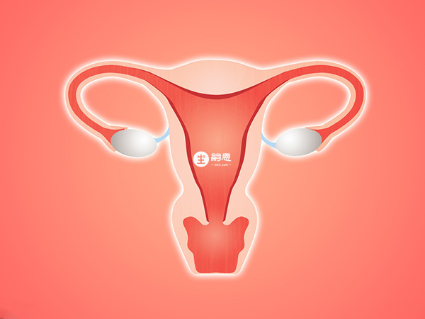 子宫腺肌病是内在性子宫内膜异位症