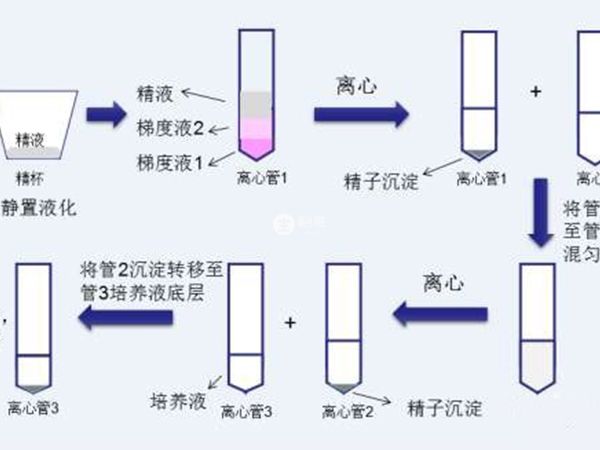 洗精術也用於Y精子分離