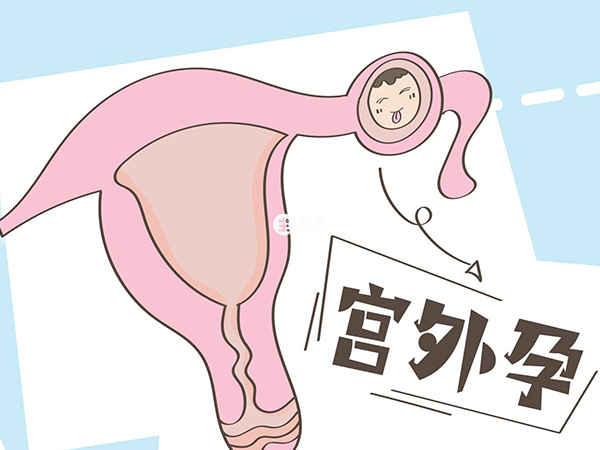 宫外孕指受精卵在子宫内腔以外着床发育