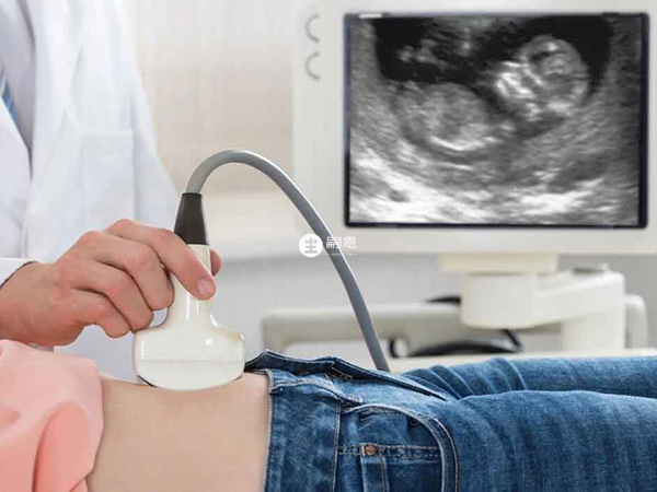 產檢時可以聽到兩個胎心