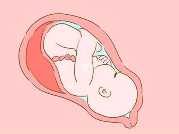 孕晚期胎位不正人工转正几率不大