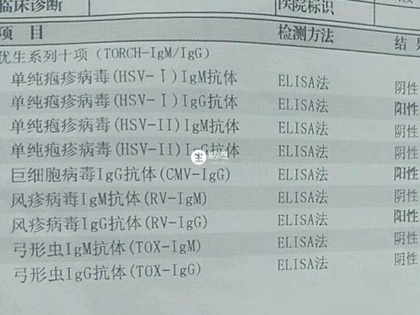 致畸五項檢查很有必要