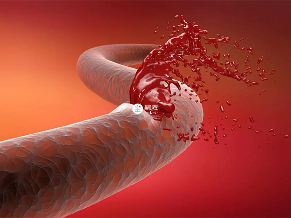 血栓弹力图显示低凝状态容易产生血栓