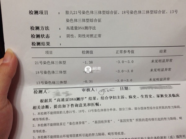 通過無創dna判斷男女主要是計算18和21跟13得來的