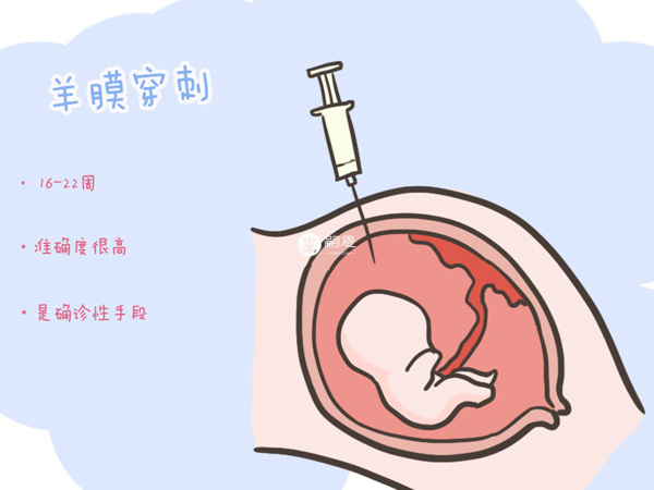 羊水穿刺準確性高