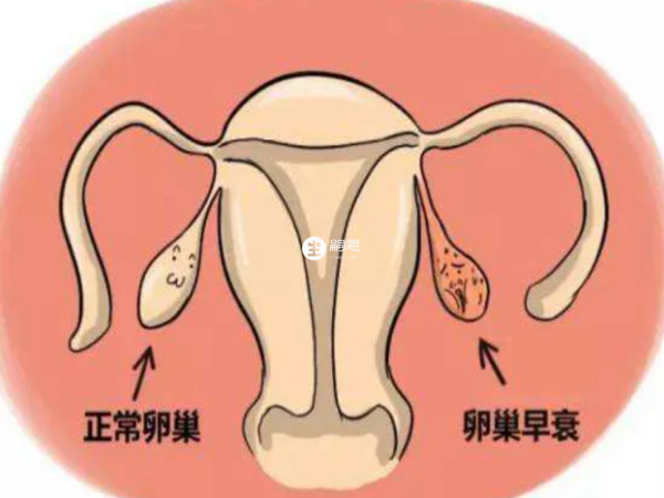 人胎盘片可以治疗卵巢早衰