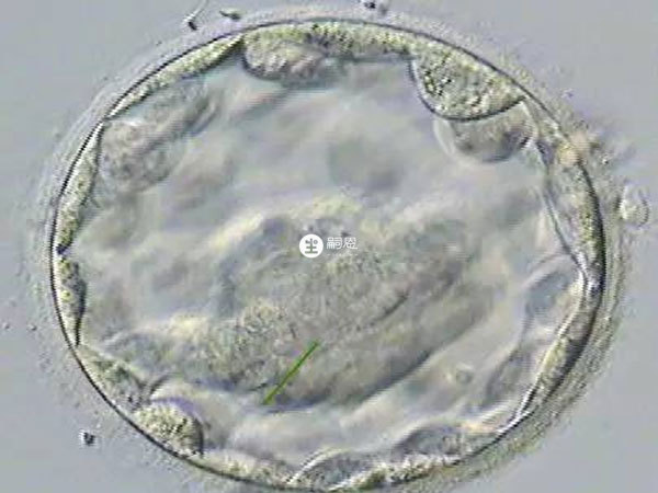 囊胚測到弱陽後不加深可能是胚胎髮育異常
