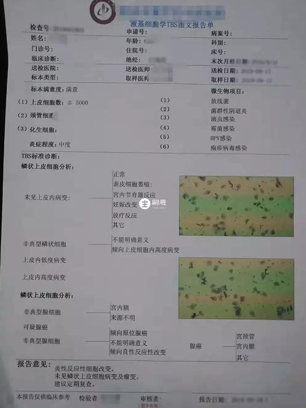 tct检查报告单