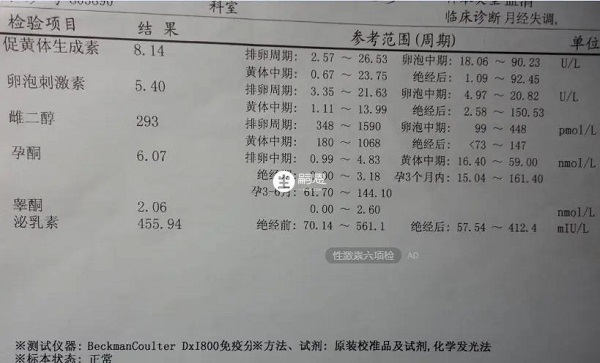 激素六項檢查不要吃過於辛辣的食物