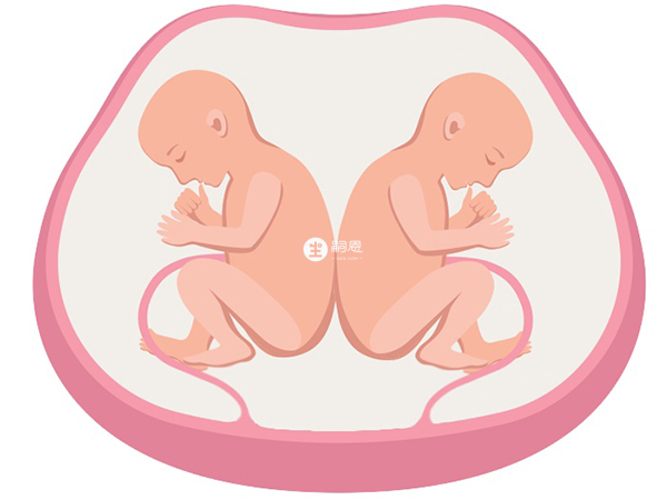 單卵雙胎共用一個胎盤