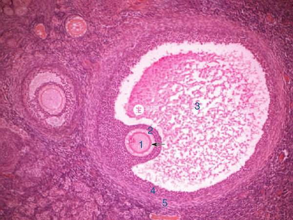 卵泡不能正常排出會直接影響生育能力