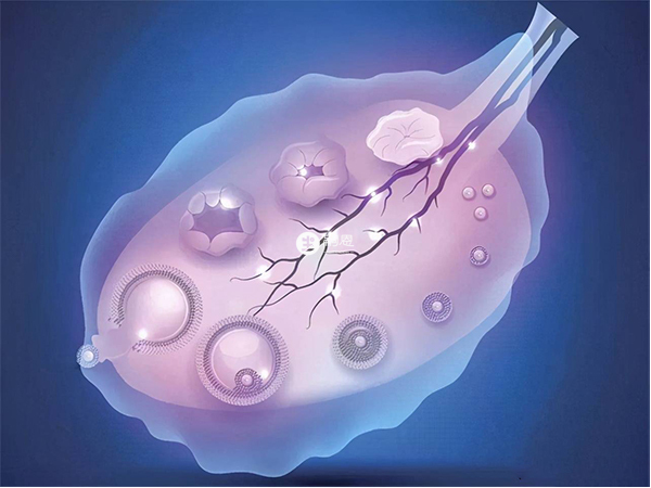 达英35常用于治疗女性多囊卵巢综合征