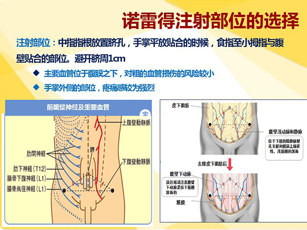 諾雷得正確注射部位