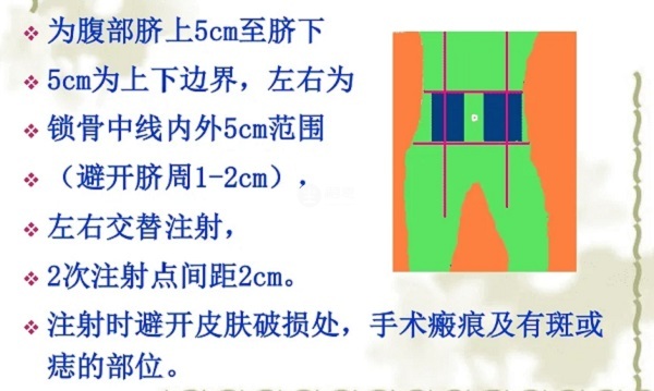 金賽恆是皮下注射藥物