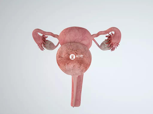 多囊卵巢综合症患者的卵巢外层有一层白膜