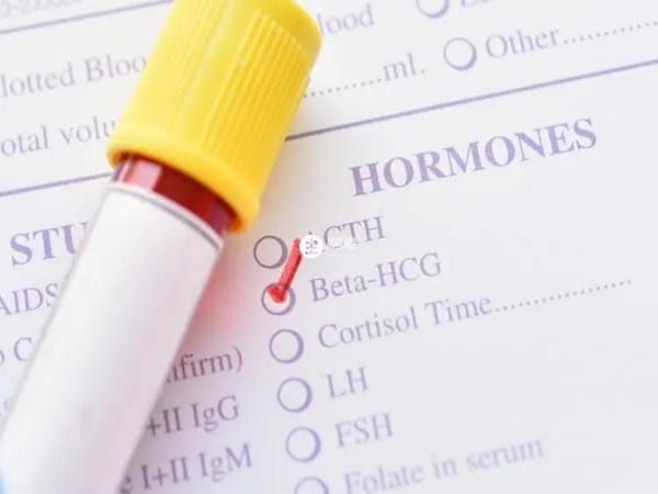 HCG是最準確度的驗孕指標