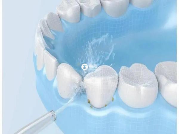 洗牙可以让牙齿变得更加的干净