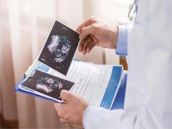 四维检查时间在孕20-24周