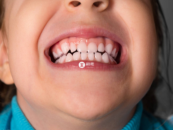 孩子6岁还不换牙可能是正常原因