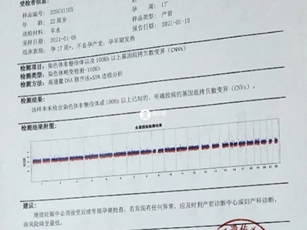 羊穿报告可看甲胎蛋白