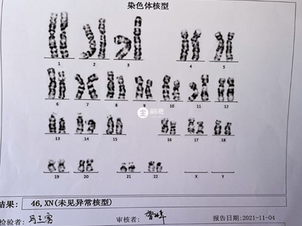 46xn说明染色体检查为正常