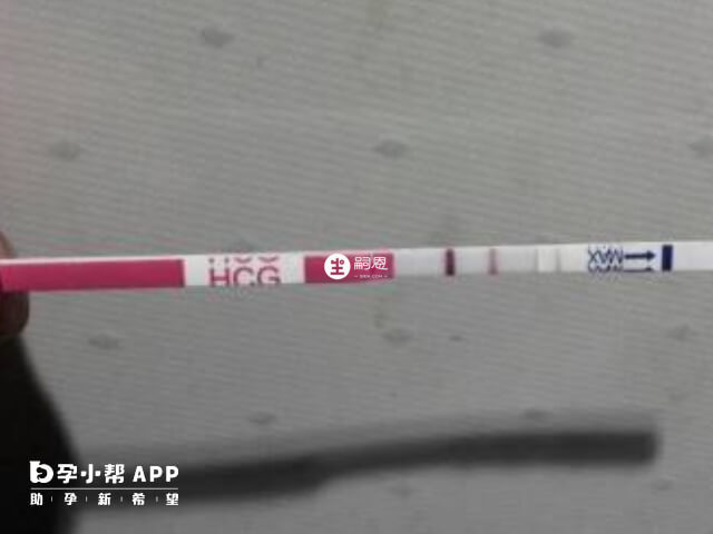 hcg也叫做人絨毛膜促性腺激素