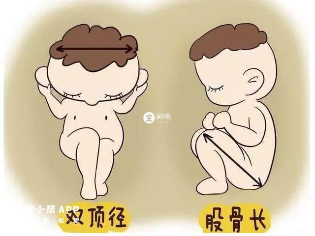 股骨長徑與身高關係不大