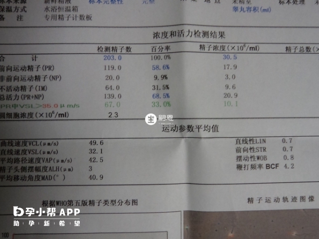 男性精子检查报告单