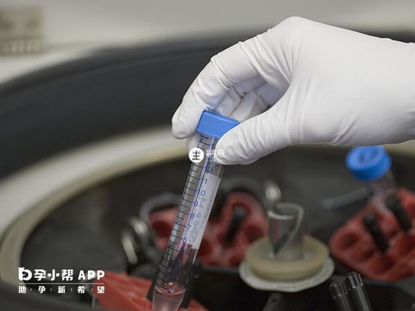南京有4家醫院可以做供精人工授精