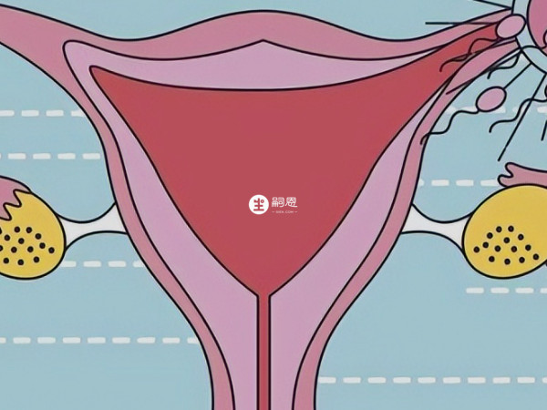 子宮內膜關係到女性的生育能力