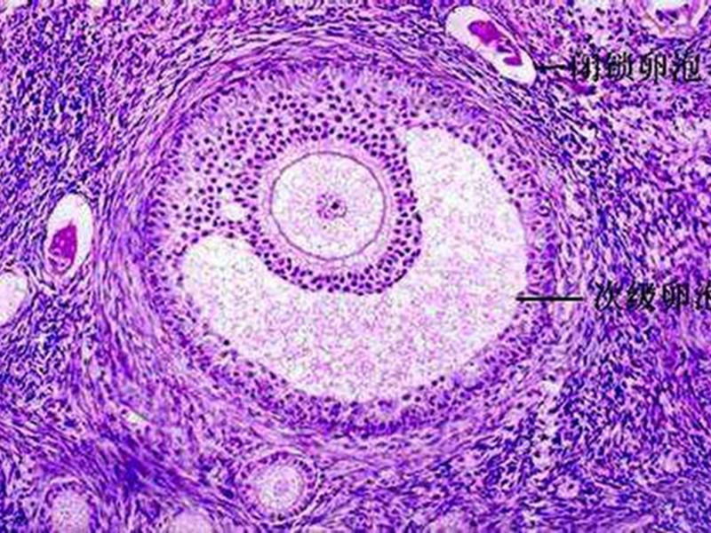 促排中很可能會出現空卵泡