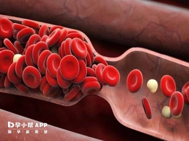 a型地貧自然懷孕胎兒易被遺傳