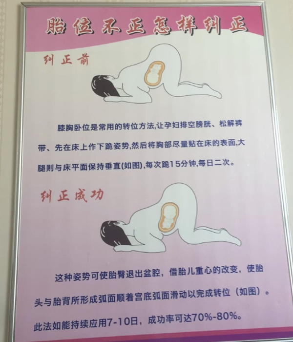 纠正胎位的姿势图解