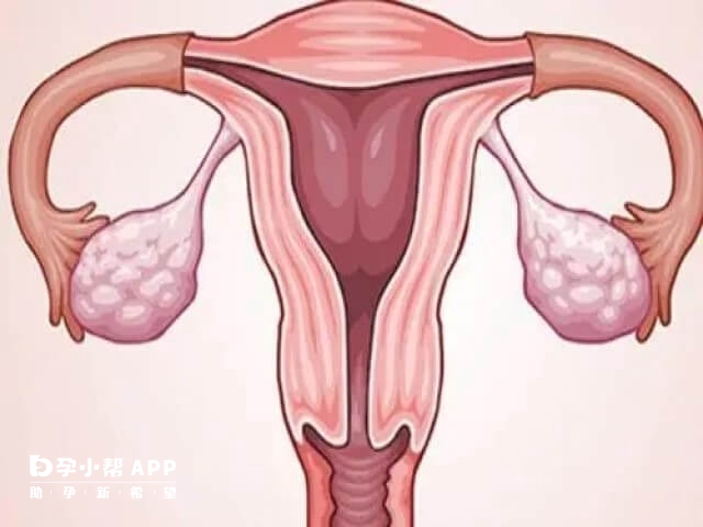 月经紊乱是多次取卵对女性身体的伤害之一
