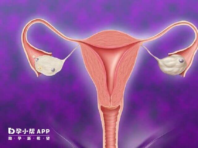 子宫异常会导致胎停育