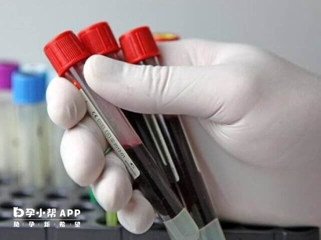 絨毛穿刺和無創DNA準確率都高