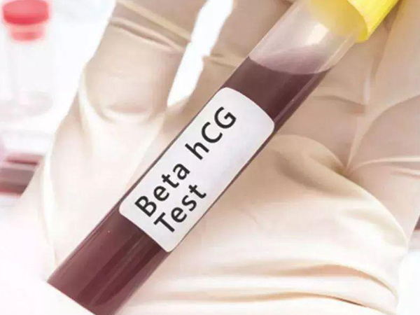 抽血驗hcg是最早的驗孕方法